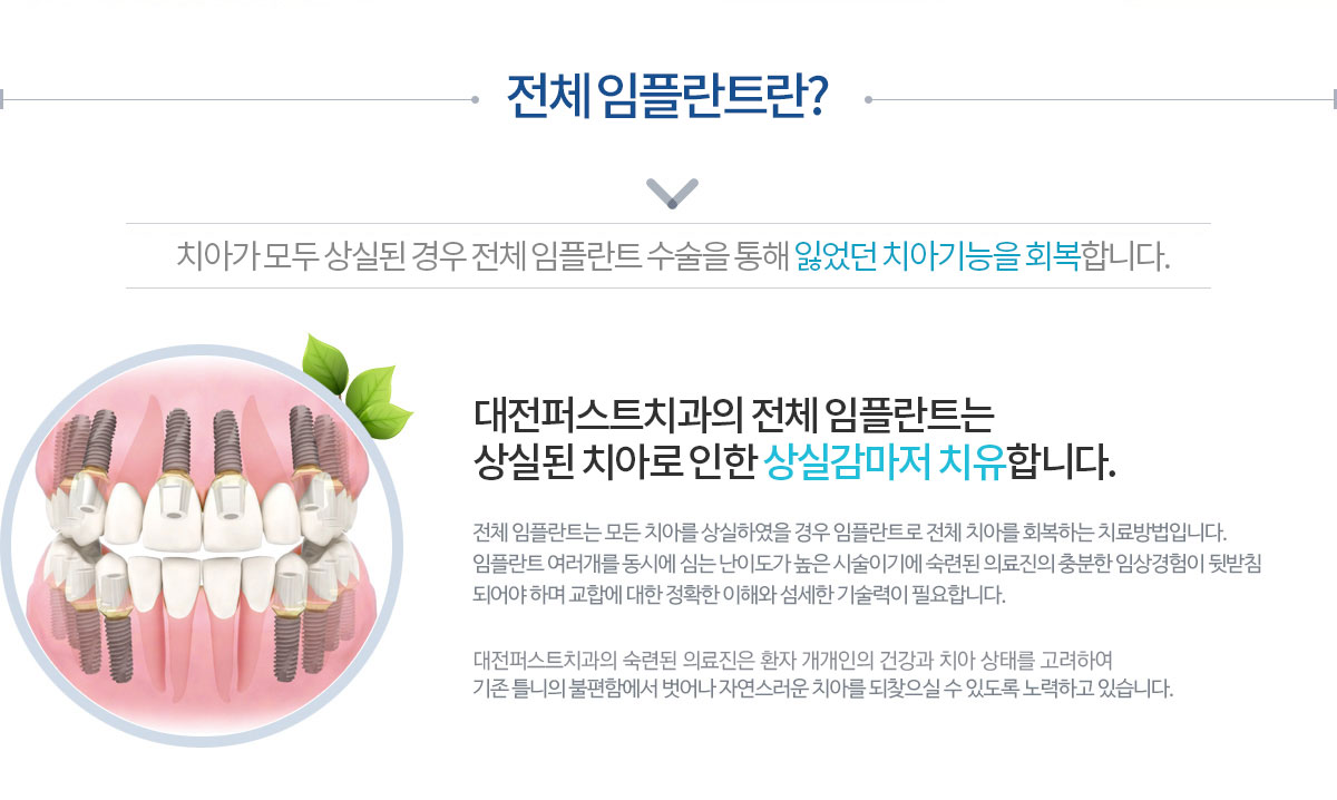 전체임플란트란?