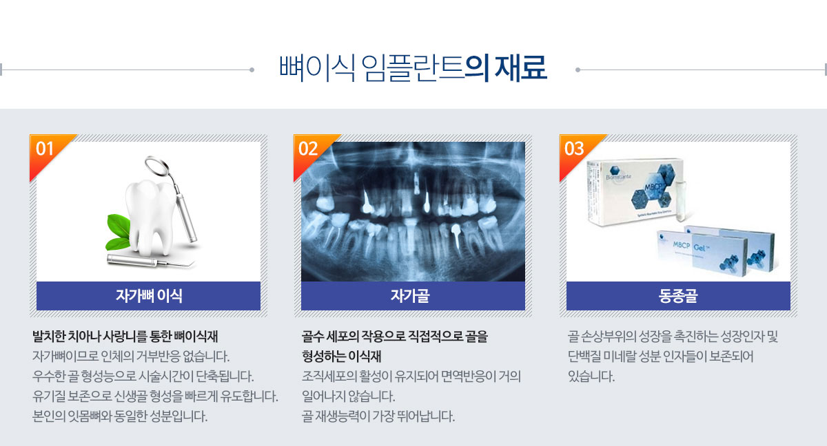 뼈이식임플란트의 재료