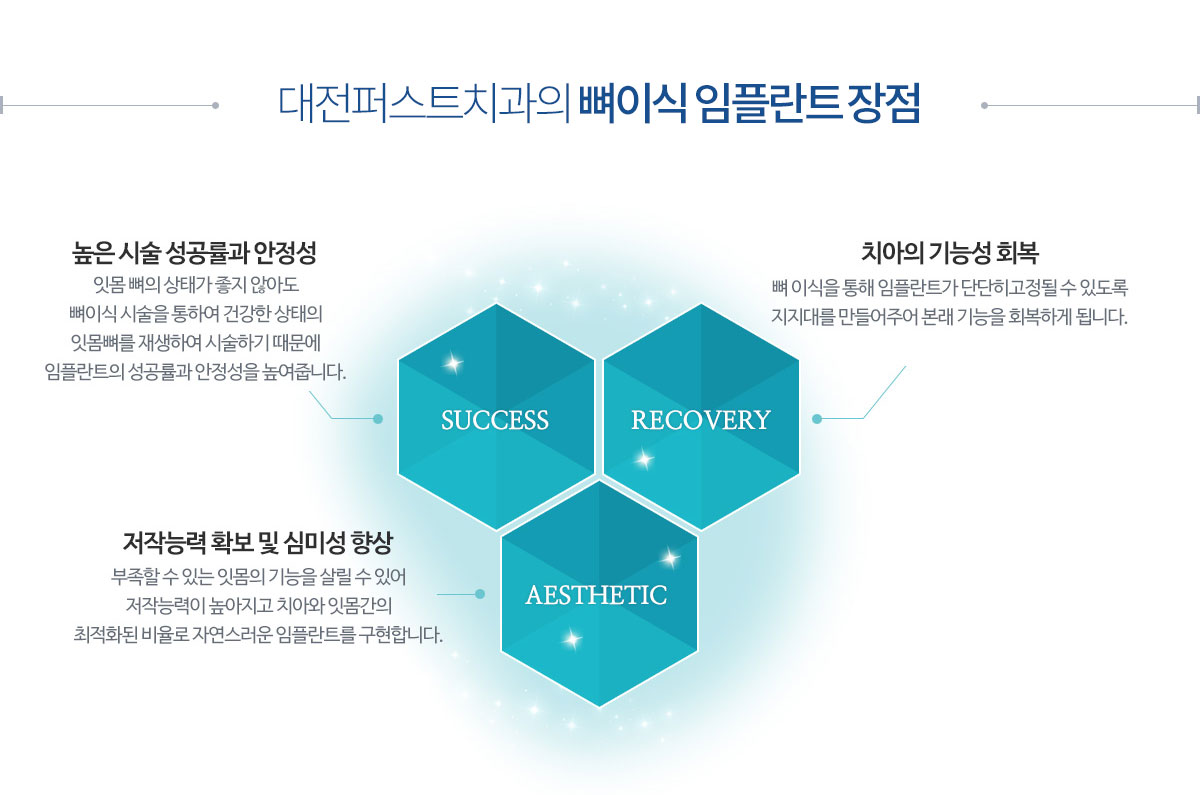 대전퍼스트치과의 어금니임플란트장점