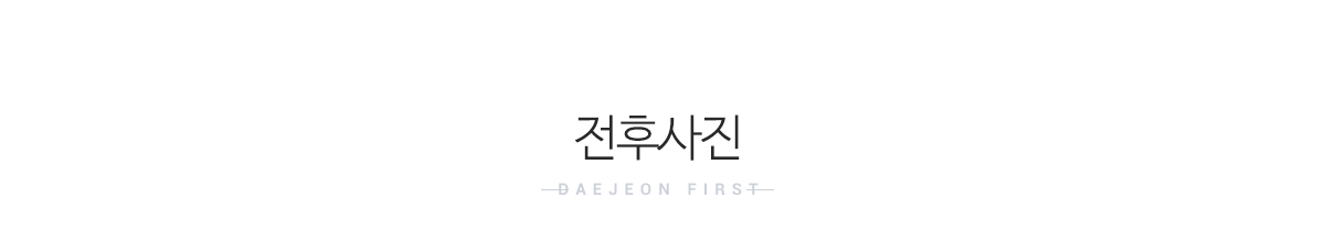 전후사진