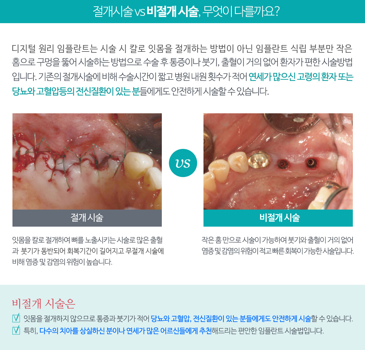 절개시술 vs 비절개 시술, 무엇이 다를까요?