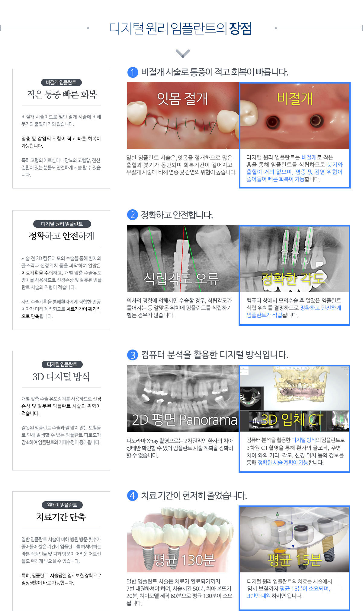 네비게이션 원리 임플란트의 장점