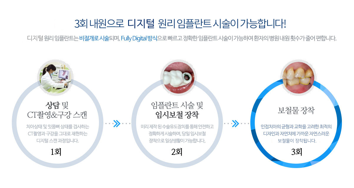 최소 3회 내원으로 네비게이션 원리 임플란트 시술이 가능합니다!