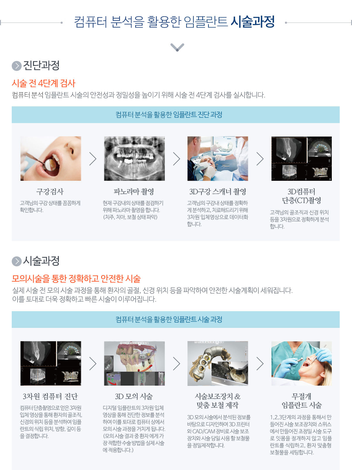 네비게이션 원리 임플란트 시술과정