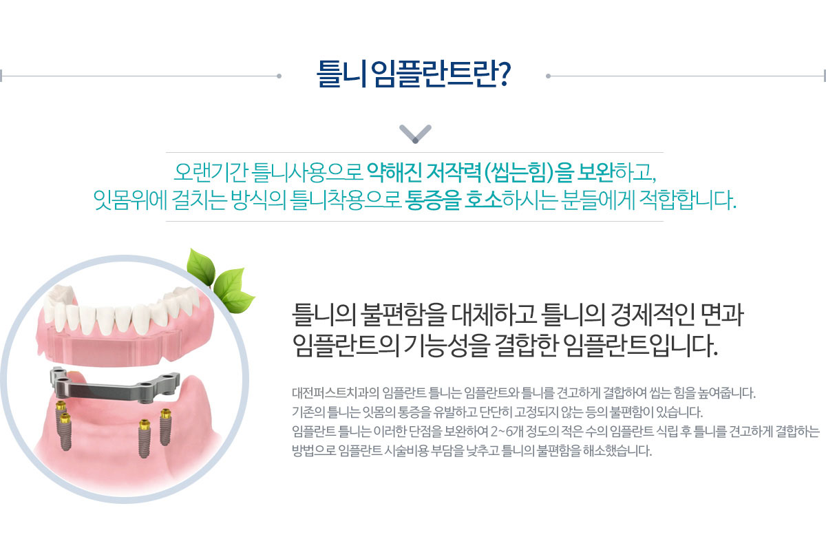 임플란트 틀니란?