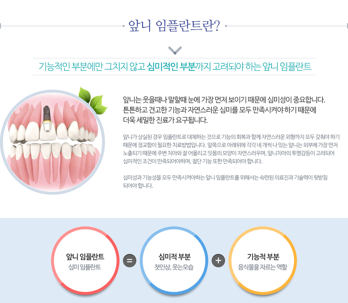 앞니임플란트란?
