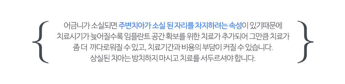 어금니임플란트 치료시기