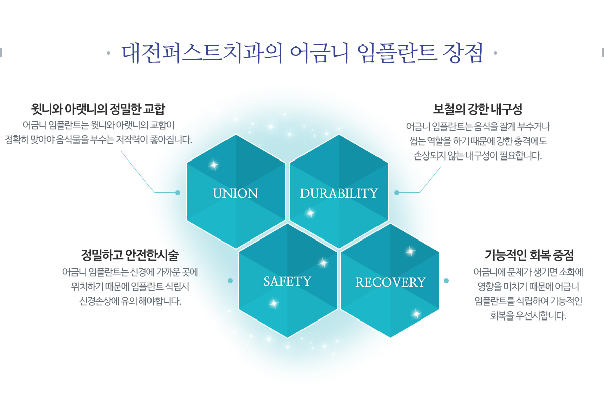대전퍼스트치과의 어금니임플란트장점