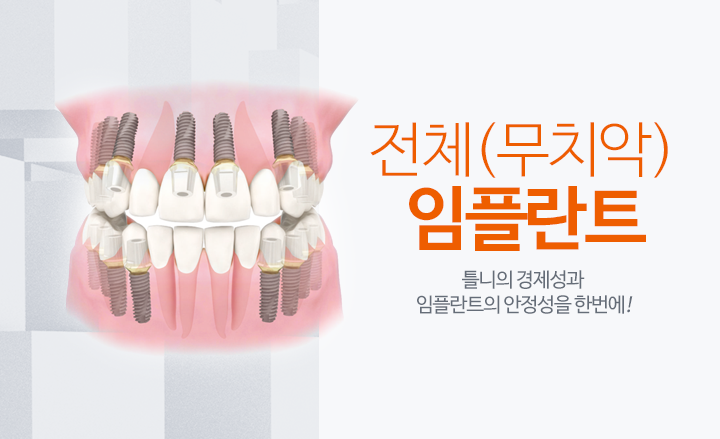 임플란트