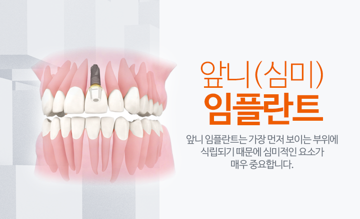 임플란트