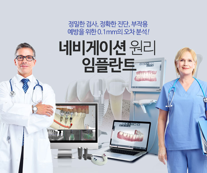 네비게이션 임플란트
