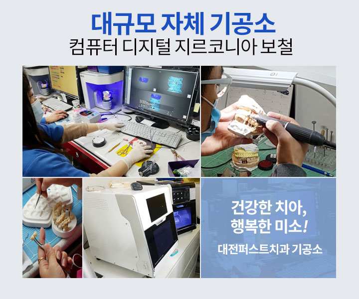 대전퍼스트치과 대규모 자체 기공소