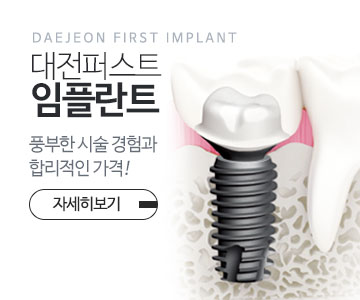임플란트