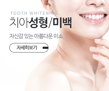 치아성형