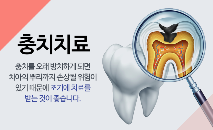 충치치료