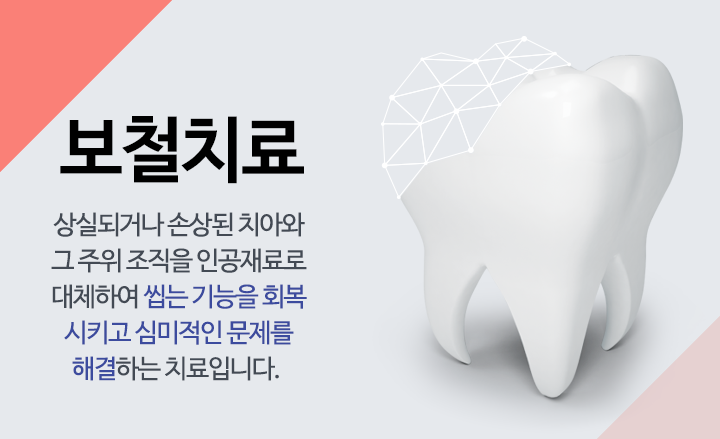 보철치료