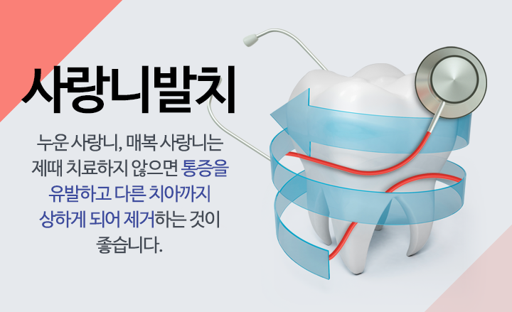 사랑니발치