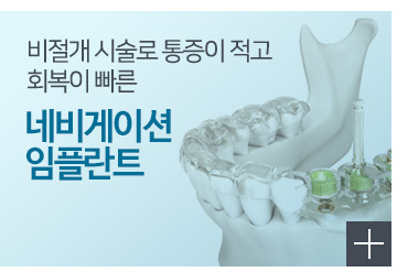 네비게이션 원리 임플란트