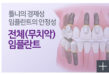 전체임플란트