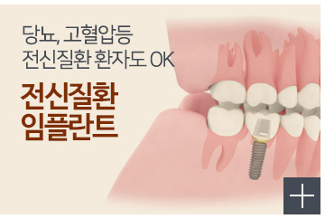 전신질환 임플란트