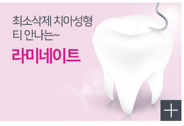 라미네이트